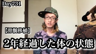 Day731 骨髄移植をして2年経ちました