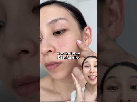 How I repaired my skin barrier in 1 week