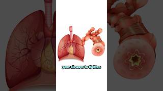 Asthma Explained: Causes, Symptoms & Management Tips #asthma #lungs #scienceexplained #lunghealth