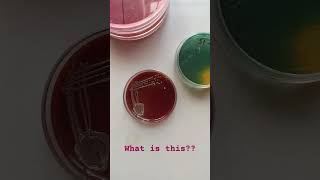 Stool Culture on Chocolate agar media #stoolculture #medicallab #shorts #lab_technician