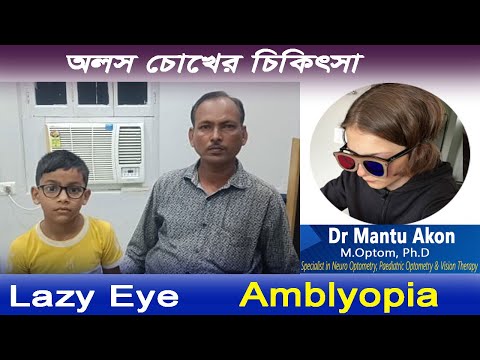 Amblyopia Lazy EyeTreatment। অলস চোখের চিকিৎসা।Dr Mantu Akon।आलसी नेत्र उपचार।Vision Therapy।