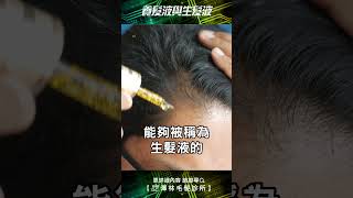 生髮液與養髮液大不同，該怎麼挑選？| 澤林毛髮診所 黃銘源醫師