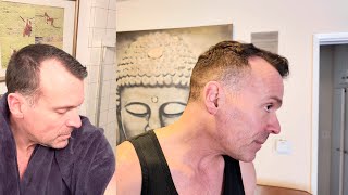 HIMS Hair Regrowth Update: My Best Results Yet! (Before & After Pics)