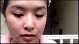 迷你小切口雙眼皮 Mini-Incision Double Eyelid Surgery
