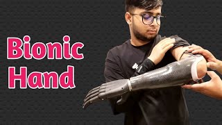 Below Elbow Bionic Hand Prosthesis#ossur#Ilimb #ottobock #bornlife #bornlifehandprice#naklihandprice