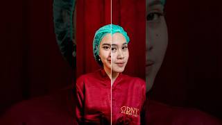 Treatment di Dny Skincare ga perlu mahal & hasilnya pasti auto glowing #semuabisacantik