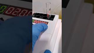 Triglycerides test of a lipemic serum sample #medtech #laboratory #medtechstudent #rmt #medtechknows