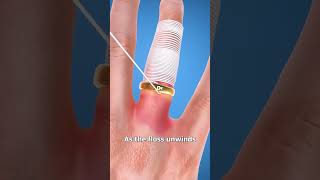 How to get a stuck ring off#ytshorts #cartoon #fact#yt #factshorts #music #ring #explorepage