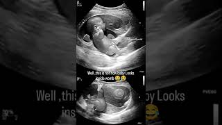 Funny AI generated Baby Movements inside Uterus