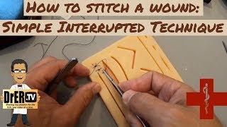 Simple Suture Repair - How to suture