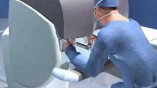 Robotic Surgery at Saint Joseph's Hospital: Da Vinci Surgical System
