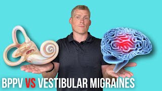 BPPV Vertigo VS Vestibular Migraine