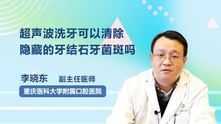 超声波洗牙可以清除隐藏的牙结石牙菌斑吗 李晓东 重庆医科大学附属口腔医院