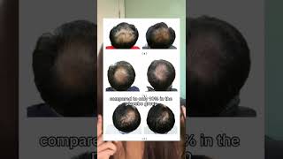 #wigs #wigtips #customwigmaker #tutorial #wigtutorial #wig #wigreview
