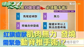 紅旗症狀肌肉無力、發燒 需緊急動脊椎手術！？ 健康2.0