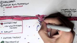 Hemostasis