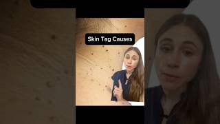 The Real Reason You're Getting More Skin Tags
