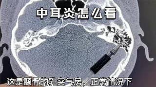 年輕男子聽力下降數年，提前衰老？聽聽醫生怎麽說