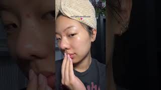 No more hiding behind filters 😭 #acne #acneproneskin #acnetreatment #antibacterial #acnefree