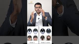 Hair Transplant or PRP? Which treatment is suitable for you? #tamiralife