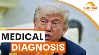 Donald Trump diagnosed with a shock health condition | Sunrise