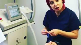 CO2 Skin Laser by Anna at Setiba Aesthetics Group