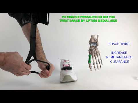 TurboMed Orthotics XTERN AFO-Thermoforming Metatarsal Contact