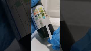 How to read and interpret urine reagent strip dipstick #mls #medtechstudent #cls #urinalysis #medtec