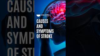 What are the symptoms of Stroke? #stroke #health #shorts