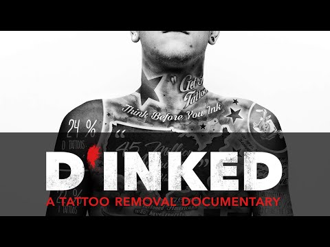 D'Inked | The Painful Truth Behind Tattoo Removal | Can You Really Wipe Your Past Clean?