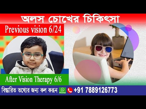 Amblyopia (lazy eye) Treatment। 6/24 previous  vision 6/6 after vision Therapy  without patching।