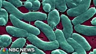 Four people dead from flesh-eating bacteria in Florida