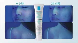 淨痘無瑕極效精華DUO+M ! 速淨全身痘