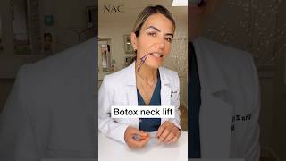 Botox Neck Lift #drbitafarrell #botox #necklift