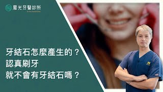【晨光牙醫診所】為什麼會有牙結石？｜徐振祥醫師