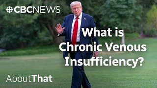 What we know about the state of Trump’s health | About That
