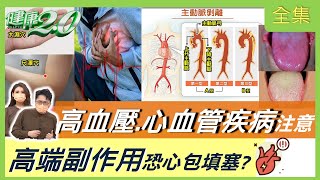 高血壓注意！ 高端副作用恐心包填塞？ 年輕人小心爆血管 健康2.0 20210912 (完整版)