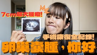 🔸強烈建議各位女仔定期做婦科檢查！畸胎瘤切除手術休養過程全公開！🔸｜卵巢囊腫，你好。