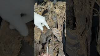 TODAS AS VÍSCERAS DO TÓRAX! - Aula de Anatomia humana