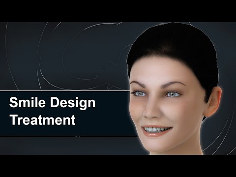 AMAZING Smile Design Treatment in 3D animation | Cosmetic Dentistry