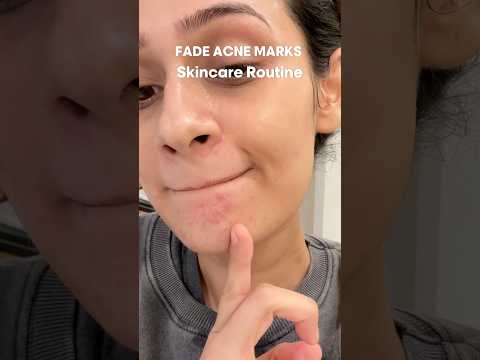 Fade Acne Marks Routine