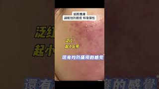 細胞美容，讓鬆弛的臉皮恢復彈性 #面部護理 #嘴邊肉 #分享 #員林spa推薦 #下垂 ☎️04-8398345
