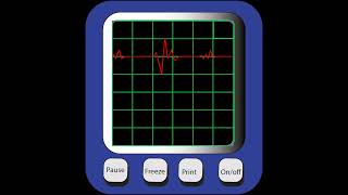 Interactive Animated Nerve Calculator | Medical Animation Demo