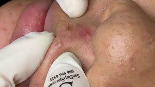 Satisfying Relaxing #ThuyTruong654