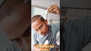 Day 11 Traya hair review || traya || #hair #hairtransformation #haircare #traya #shorts #shortsfeed