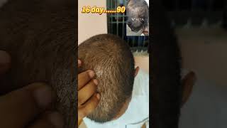 16 day use adivasi herbal hair oil and result and review #ayurvedichairoil #adivasihairoil #shorts