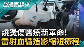 燒燙傷醫療新革命! 雷射血液微循環造影系統加快判斷傷口未來走向 判讀血液循環狀況 縮短醫療時間有效減少誤判│記者 陳麗雯 王明輝 張逸民│【台灣亮起來】20221114│三立新聞台