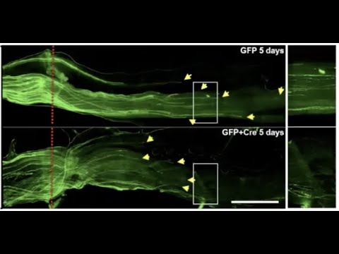 Epigenetic Rejuvenation to Enhance CNS Axon Regeneration