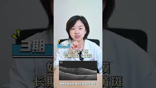 黄斑前膜，一定要手术吗 #抖出健康知识宝藏 #医疗健康创作训练营 #眼科医生吕骄 #黄斑前膜 #黄斑前膜手术