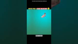 A Gaint Blister 😯 #shorts #facts #mirjaexplain